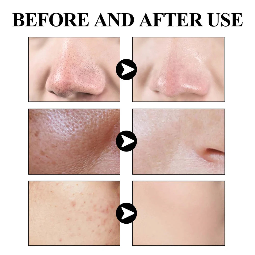 West & Month Blackhead Removing Solid Mud Face Mask